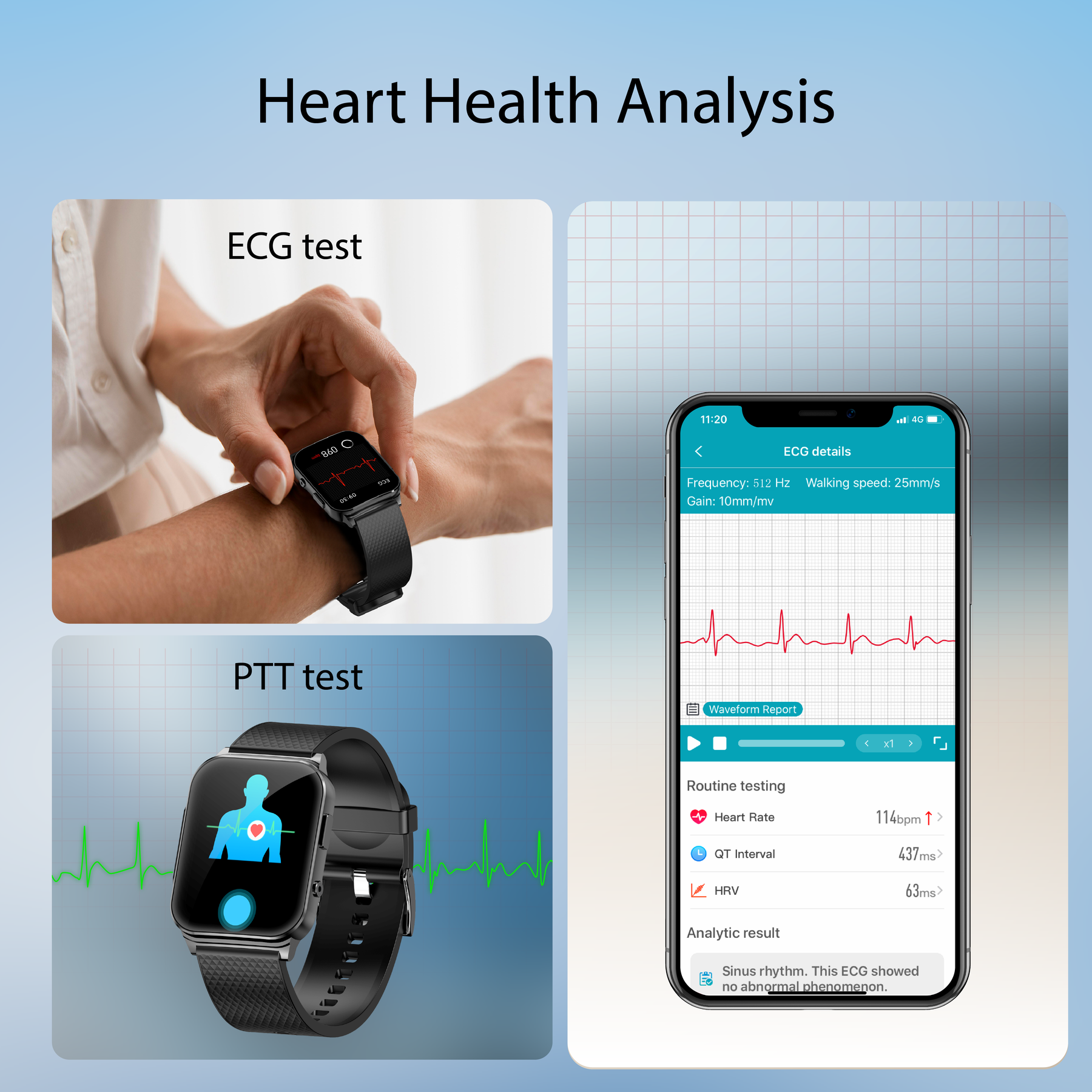 KH03 Health Smart Watch ECG/EKG Heart Rate Blood Pressure Sedentary Reminder